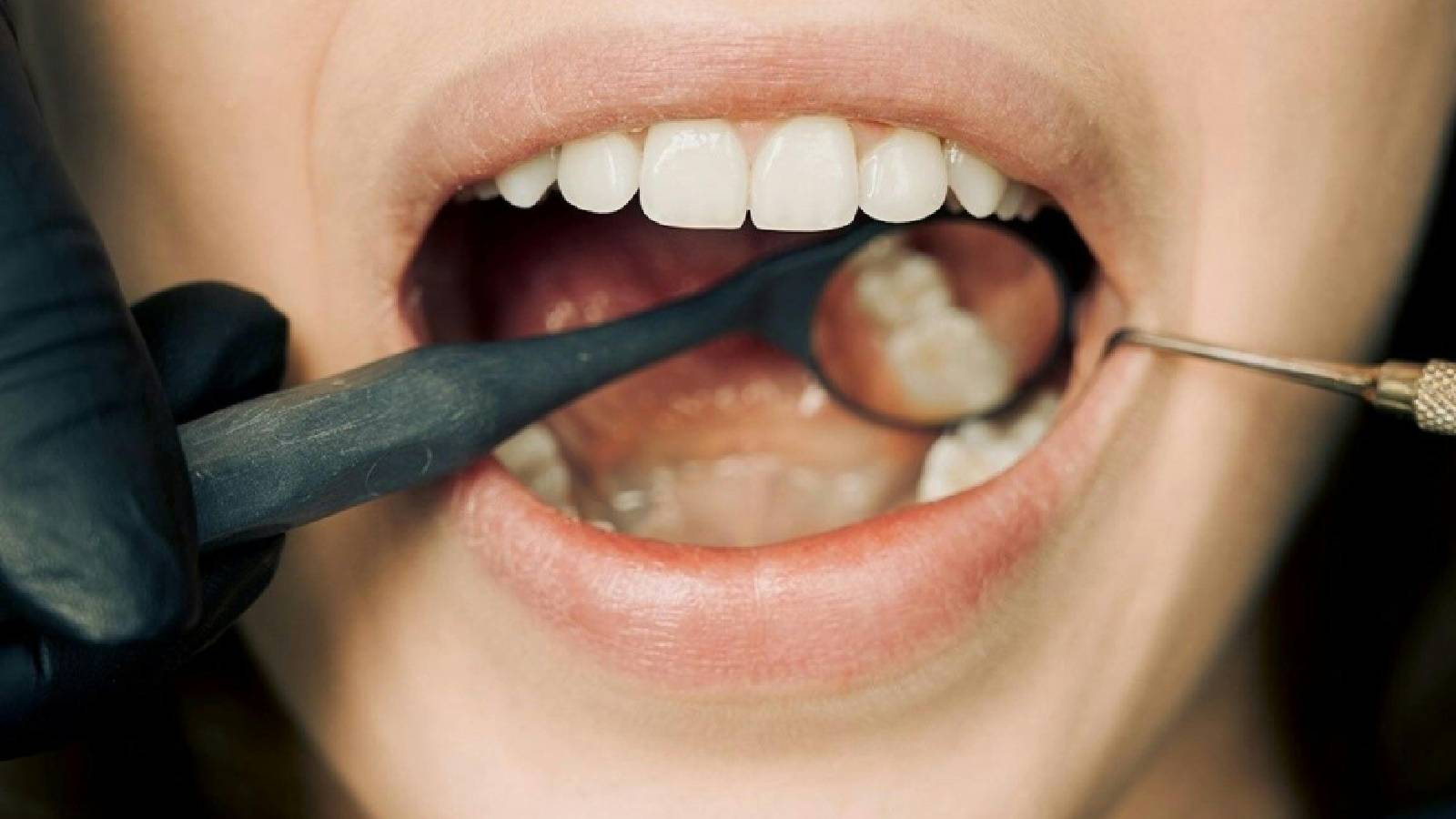 Oil pulling can turn around your dental health! Here’s how